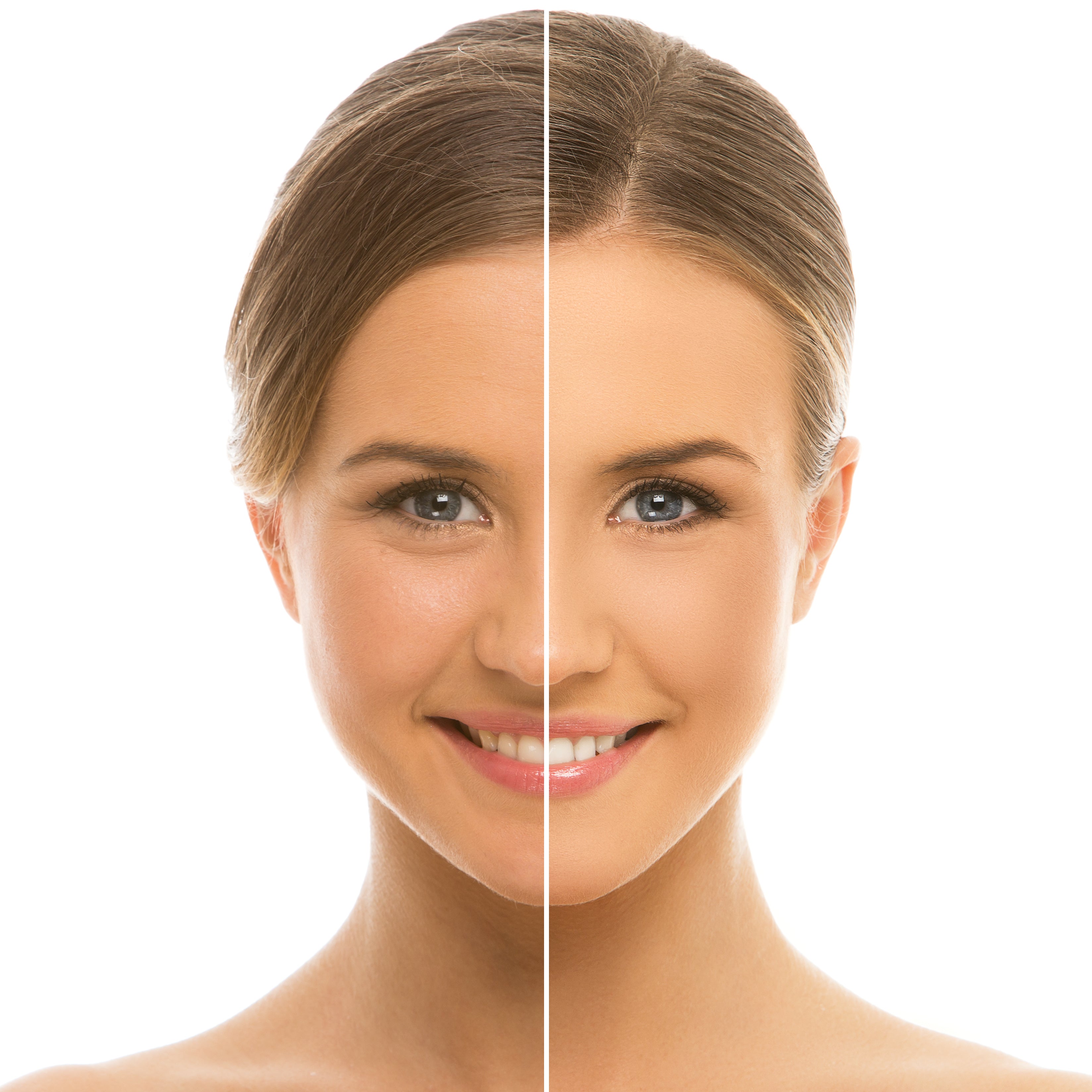¿Cómo prevenir las arrugas prematuras en el rostro?